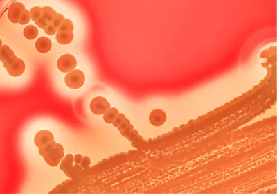 Orange colony of bacteria on red medium